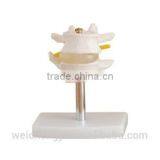 Lumbar Set (2 Pieces)