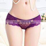 OEM or ODM 2016 Hot Sex Open Back Sexy Underwear thumbnail-1