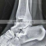 Imaging Medical Ray Film,digital X-ray Cr,agfa Thermal Film Sale From Manufacturer thumbnail-1