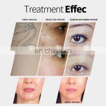 Hot Sale Portable Laser Tattoo RemoverPicosecod Q Switch Nd Yag Tattoo Removal System thumbnail-5