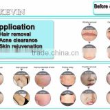 2016 new Popular SHR OPT system IPL hair removal/ permanent fast hair removal ipl hair removal