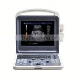 Cheapest 4d color doppler ultrasound from china with low price