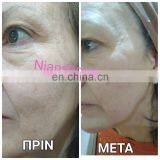 Double Screen 3 In1 Multi-function OPT IPL Laser Hair Removal Tattoo Removal Equipment Laser Hair Removal for Salon thumbnail-7