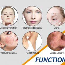 ADM Portable DPL Laser Remover Hair Intense Pulsed Light Permanent Hair Removal Laser Dpl Skin Rejuvenation Machine thumbnail-5