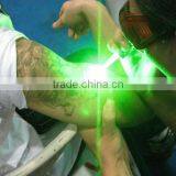 532nm Nd Yag 532nm Green Q Switch Laser Tattoo Removal Laser Machine Hori Naevus Removal thumbnail-1