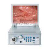 High Resolution Electronic Video Gastroscope And Colonoscope,Medical Equipment Endoscopy System Price With LED Light Source thumbnail-1
