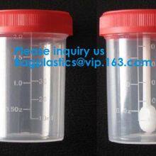 Disposable Urine Specimen Cup/Urine Sample Containers/Urine Collection Cup,Sterile Disposable Hospital Sample 60ml 100 thumbnail-4