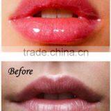 Lip Plumping Enhancer,natural Lip Enhancement thumbnail-5