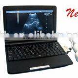 2016 Promotion Medical Portable Laptop Clinic Hospital Ultrasound Scanner Machine With 3.5Mhz Convex Probes--RUS-9000F-Shelly thumbnail-1