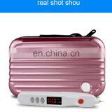 Korean Technology Portable Skin Care Product Laser Mole Removal Pen Spot Removal Plasma Pen thumbnail-3