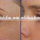 NL-HS202 2016 HOT SALE!!! Diamond Dermabrasion Facial Machine/beauty Salon Equipment/promote Circulation thumbnail-6