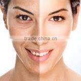 IPL Beauty Machine to Get Face Rejuvenation With Hair Removal Function thumbnail-3