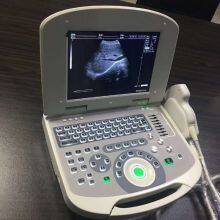 All Digital Ultrasonic Diagnosis SystemPortable Digital Acoustic Diagnostic Scanner for Human in Hospital thumbnail-2