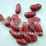 Dark Red Kidney Beans thumbnail-1