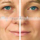 The Most Impressive Safe Beauty Therapy Radio Frequency For Home Use Portable Machine thumbnail-4