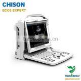Medical User-friendly B/w 2d Portable Ultrasound CHISON ECO3 EXPERT