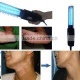 2016 Made in China: Portable Uvb Vitiligo Treatment Lamp, Anti-vitiligo Treatment thumbnail-4