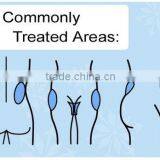 2016 Top Sale Slimming Machine Fat Freezing Cool Tech Machine thumbnail-5