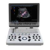 15inch Display 3 Transducer Ports Ultrasound Machine 3D 4D