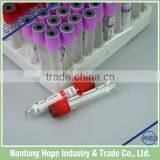 Hospital Blood Collection Tube Vacuum thumbnail-4