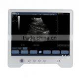 B Mode Portable Ultrasound Price TS20 thumbnail-4