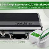 Portable 5MP Iridology Iriscope Analyzer thumbnail-3
