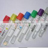 Plain Tube vacuum blood collection tube/vacutainer