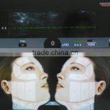 2016 CE Approval Transducer HIFU Face Lift Beauty Machine thumbnail-6