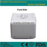 CE Approved Portable B-Mode Ultrasonic/ Ultrasound Scanner With 3.5Mhz Multi-frequency Convex Probe RUS-6000D thumbnail-4