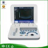 Hot Cheapest Large Screen 10.4 Inch Laptop Ultrasound Scanner Machine With Probe--RUS-9000F2 thumbnail-1