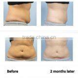 2014 Best Quick Slim! With CE&ISO Diode Lipo Laser Slimming Machine LP-01/ i Lipo Laser Slim me Use(809nm Laser,led) thumbnail-4