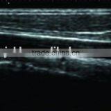 CE Hot Sale Portable Laptop Ultrasound Scanner/Machine Hospital Clinic Diagnosis With Probe/Transducer and Printer thumbnail-4