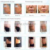 Latest Technology Hifu Ultrasonic Lposuction Equipment Skin Lifting V8 Body Shaping Machine Skin Rejuvenation thumbnail-3