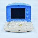 Trolley Color Doppler Ultrasound Scanner System (YJ-U300t) thumbnail-5