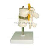 Human Body Anatomy Spine Model Lumbar Vertebra thumbnail-4
