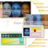 2014 Newest uv Light Facial Skin Analyzer Suitable For Windows 8 and Windows 8.1 thumbnail-5