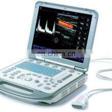 Good condition  used Portable mindray M5 color ultrasound laptop mindray machine M5 ultrasound