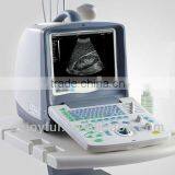 Portable Multi Transducer Ultrasound Machine EM-2000 thumbnail-1