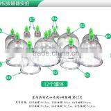 Chinese Medical Therapy Vacuum Cupping Apparatus thumbnail-2