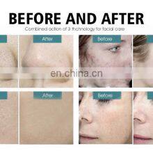 Portable Beauty Equipment Home Diamond Dermabrasion Tips Microdermabrasion Machine for Sale thumbnail-3