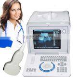 Good Quality Ultrasound Scanner Portable Ultrasonic Diagnostic Machine RUS-6000D With 3.5MHz Convex Probe thumbnail-1