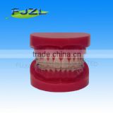 Orthodontic Teeth Model(normal Tooth, Ceramic Brackets)/dental Orthodontic Models thumbnail-1