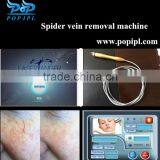 Facial Veins Removal/spider Veins Removal Machine/vascular Spider Vein Removal thumbnail-2