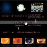 New Product,Protect Eyes, Anti-blue Light, Anti-blue Ray Screen Protector thumbnail-5