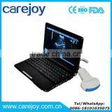 CE Approved Laptop Ultrasound Scanner/machine With Convex Linear Probe/Transducers Price thumbnail-1