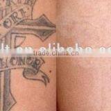 Merry Christmas! Professional Home Use Laser Pigment nd Yag Machine for Q7 thumbnail-6