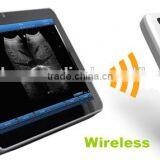 Mobile Phone Type Ultrasound Scanner thumbnail-1