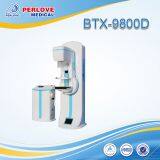 Mammography Xray Machine BTX-9800D With CR System thumbnail-1