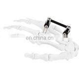 CE & ISO Marked Mini Fragment External Fixator (Finger and Palm) Surgical Instrument thumbnail-6