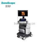 High Quality Ultrasound Color Dopper SonoScape S50 Price